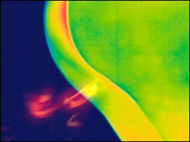 thermogram of a human fart